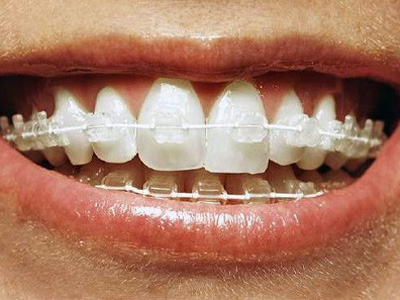 Amira Aesthetics | Root Canals, Preventative Program and Invisalign reg 
