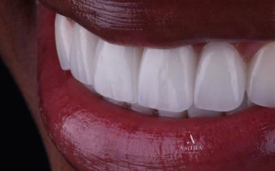 Amira Aesthetics | Laser Dentistry, Root Canals and Dentures