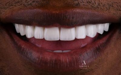 Amira Aesthetics | CEREC reg  Crowns, Oral Exams and Dentures
