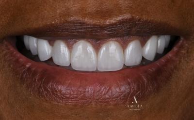 Amira Aesthetics | Oral Exams, Dentures and Invisalign reg 