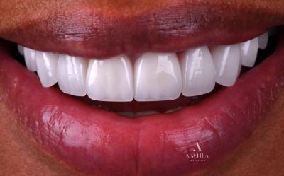 Amira Aesthetics | Orthodontics, Invisalign reg  and Six Month Smiles reg 