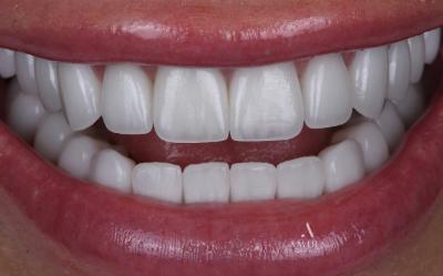 Amira Aesthetics | CEREC reg  Crowns, Botox reg  and Orthodontics