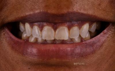 Amira Aesthetics | CEREC reg  Crowns, Night Guards and Dental Fillings